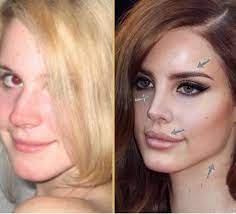 This video is about my opinion on lana del rey having plastic surgery. Privee Clinic Lana Del Rey Then And Now She S Always Been Beautiful But Her Face Has Changed Considerably Over The Years What Do You Think She S Had Done Celebrityfaces Celebrityplasticsurgery Fillers