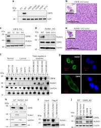 The Transcription Factor Cbfb Suppresses Breast Cancer