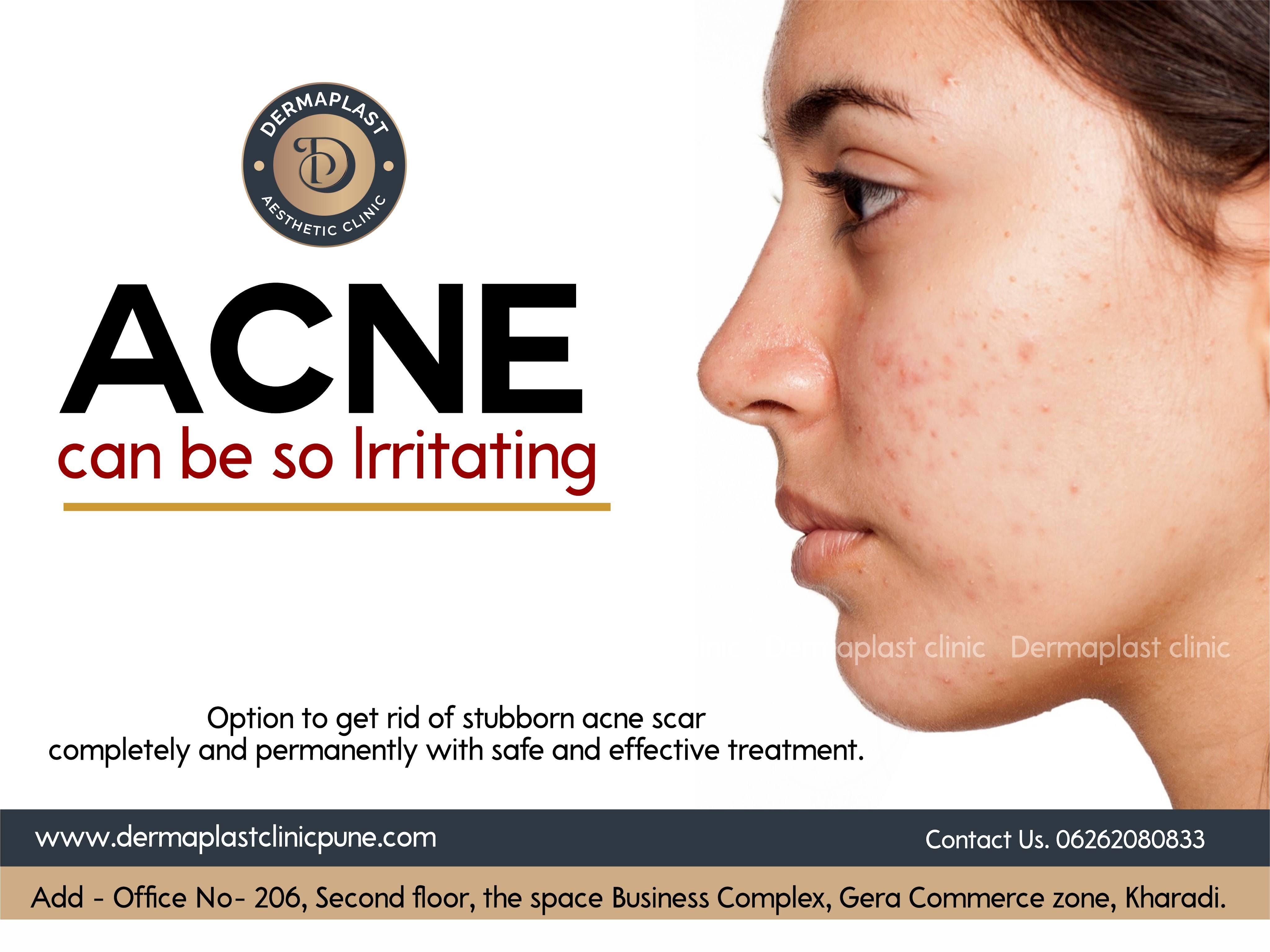Acne Treatment product image