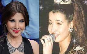 نشرت الفنانة نانسي عجرم، صورة لها على موقع تبادل الصور والفيديوهات انستجرام، ظهرت خلالها قبل وبعد الولادة. Ù†Ø¬Ù…Ø§Øª Ù‚Ø¨Ù„ ÙˆØ¨Ø¹Ø¯ Ø¹Ù…Ù„ÙŠØ§Øª Ø§Ù„ØªØ¬Ù…ÙŠÙ„ Ù…Ø¬Ù„Ø© Ø³ÙŠØ¯ØªÙŠ