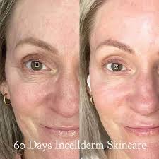 ✨ Ladies, let's talk about estrogen and skincare! 💁‍♀️ Did you know that  estrogen plays a crucial role in keeping our skin hydrated, maintaining  collagen and elastin levels, and preserving skin thickness?