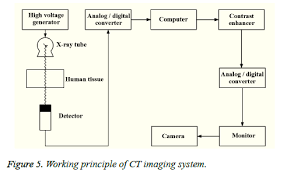 Ery of soft tissue function following tendinopathy. Diagnosis Study On Sports Injuries Combined With Medical Imaging Technology