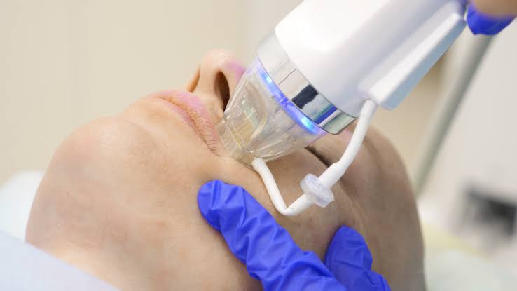 RF and Fractional Micro-needling | Marsh Medical Skin Clinic, Huddersfield,  West Yorkshire