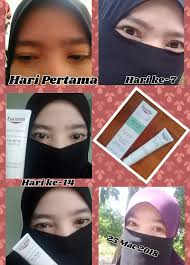 Für einen gleichmäßigen und strahlenden hautton. Kulit Bebas Jerawat Dalam Masa 2 Minggu Dengan Eucerin Proacne Solution A I Clearing Treatment Mohazsue