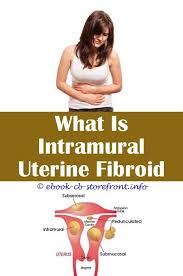 Epingle Sur Fibroid Specialist