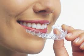 Orthodontic Correction Of Canted Occlusal Plane Part 4 | Ppt