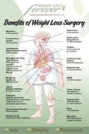 Pin On Weight Loss Surgery