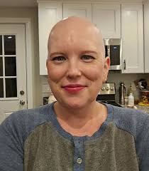 Two weeks post final chemo and I'm feeling great! Lashes = magnetic. Brows  = drawn in. Head = shiny and bald. So it'll be a minute until I have any  hair, but