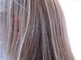 Hair loss differs from hair shedding 9 Unusual Uses For Aspirin Restore Hair Color Aspirin For Hair Hair Loss Remedies