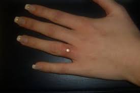 Dermal Finger Piercing Finger Piercing Piercing Tattoo Dermal Piercing