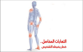 علاج التهاب مفصل الكوع بالاعشاب موسوعة