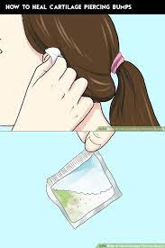 Index Of Piercing Bump Cartilage Bump Cartilage Piercing