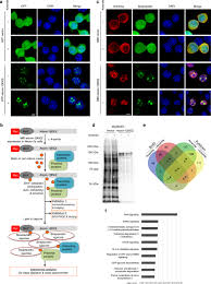 Model incetare cim somaj art.65.alin.1. The Ataxin 1 Interactome Reveals Direct Connection With Multiple Disrupted Nuclear Transport Pathways Nature Communications