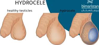 Image result for Scrotum