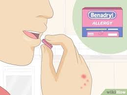 How To Treat Bed Bug Bites 12 Steps With Pictures Wikihow
