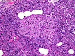 Check spelling or type a new query. Webpathology Com A Collection Of Surgical Pathology Images