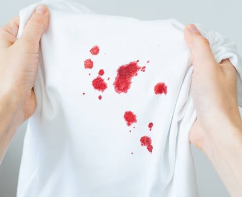 Fresh Organic Spotting on White Fabric, AI generated