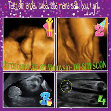 Maybe you would like to learn more about one of these? Baby Boy Or Girl Ultrasound Scan Baby Malaysia Dr Siti Scan