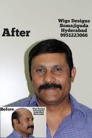 Gents wigs in Chirag Ali Lane @9951223066