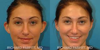 Richard Parfitt, MD, Board Certified Facial Plastic Surgeon