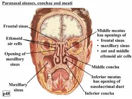 Nasal cavity carcinomas spread to adjacent sinuses depending on the location of origin: Nasal Cavity And Paranasal Sinuses Flashcards Quizlet