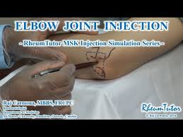 Image result for Elbow Joint Injection