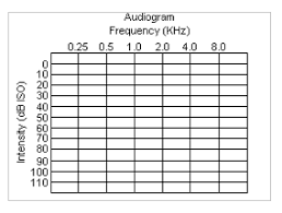 1000 Images About Audiology On Pinterest Pitch Cochlear