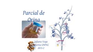 Parcial de orina es el análisis de la orina puede dividirse en tres etapas: Parcial De Orina By Juliana Vega