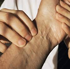 See full list on mayoclinic.org Ganglion Cyst Treatment At Kayal Orthopaedic Center In New Jersey