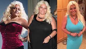 And chelsea clinton is one of them, another common thing on this plastic surgery is the politic that comes behind it where everyone that does plastic surgery always tries to cover and denies that they are really did plastic surgery. Beth Chapman Plastic Surgery Before And After Pictures 2021