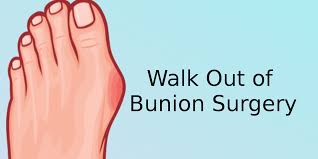 Pin On The Bunion Cure