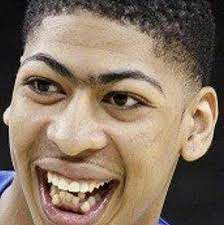 The anthony davis sports brow and grill. Badluckbrian Auf Twitter Teeth Are Fucked Up Worse Than Anthony Davis Http T Co 1gjjsufa