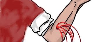 The Benefits of Bloodletting – The Catalyst