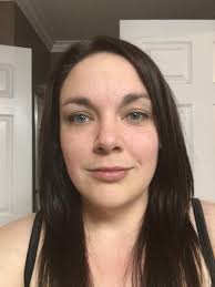 Rheumatoid arthritis affects physical appearance