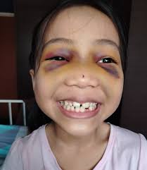 7-year-old S'pore girl allegedly flung off seat