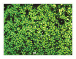 Image result for Phragmanthera capitata