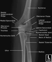 Image result for Elbow XRay