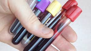 Radioterapia in mai multe parti ale corpului sau la oasele din pelvis, picioare, piept sau abdomen. Tumori Canceroase Depistate Oriunde In Corp Cu O AnalizÄ De Sange Ehealth Romania