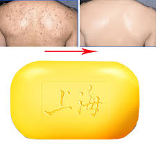 Check spelling or type a new query. Sulfur Soap For Acne Skin Cleanser Life Changing Products