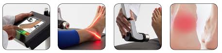 Fda Market Cleared Laser Treatment For Plantar Fasciitis Heel Pain Fx 635