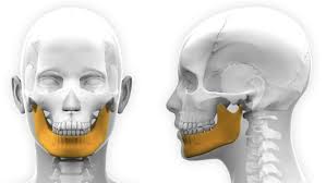 Définition du mot mandibule : Osteotomie Mandibulaire Chirurgien Maxillo Facial Stomato 94 77