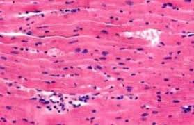 Promeristem, yaitu suatu jaringan meristem yang sudah ada sejak tumbuhan masih dalam tingkat embrio. Hubungan Sistem Otot Dan Saraf Anatomi Organ Dan Fungsi