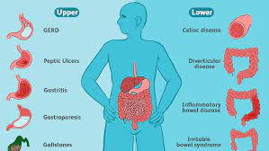 Organs associated with left side of body beneath anterior rib cage are colon and spleen. Symptoms Of Common Stomach And Digestive Problems