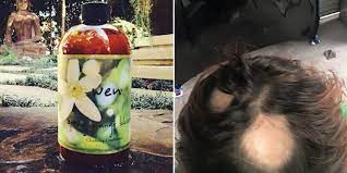 You may unsubscribe from the newsletters at any time. Fda Launches Wen By Chaz Dean Hair Loss Investigation
