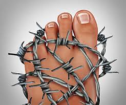 Baking Soda Eases Painful Arthritis Study Finds Gout Symptoms Arthritis Treatment Gout