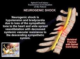 Image result for Spinal Shock