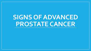 Learn more about the signs and symptoms here. Signs Of Advanced Prostate Cancer