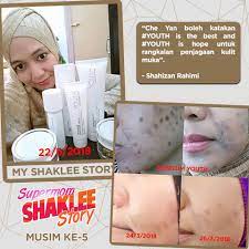 Kulit kamu dijamin sehat dan mulus dalam waktu singkat! Cara Hilangkan Parut Hitam Di Muka Kembali Cantik Ohcantik Com