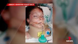 Mother's Warning Of E-Scooters