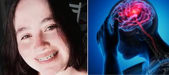 Mujer embarazada tenía dolores de cabeza y sufrió un aneurisma: los médicos  luchan por mantener con vida a su bebé